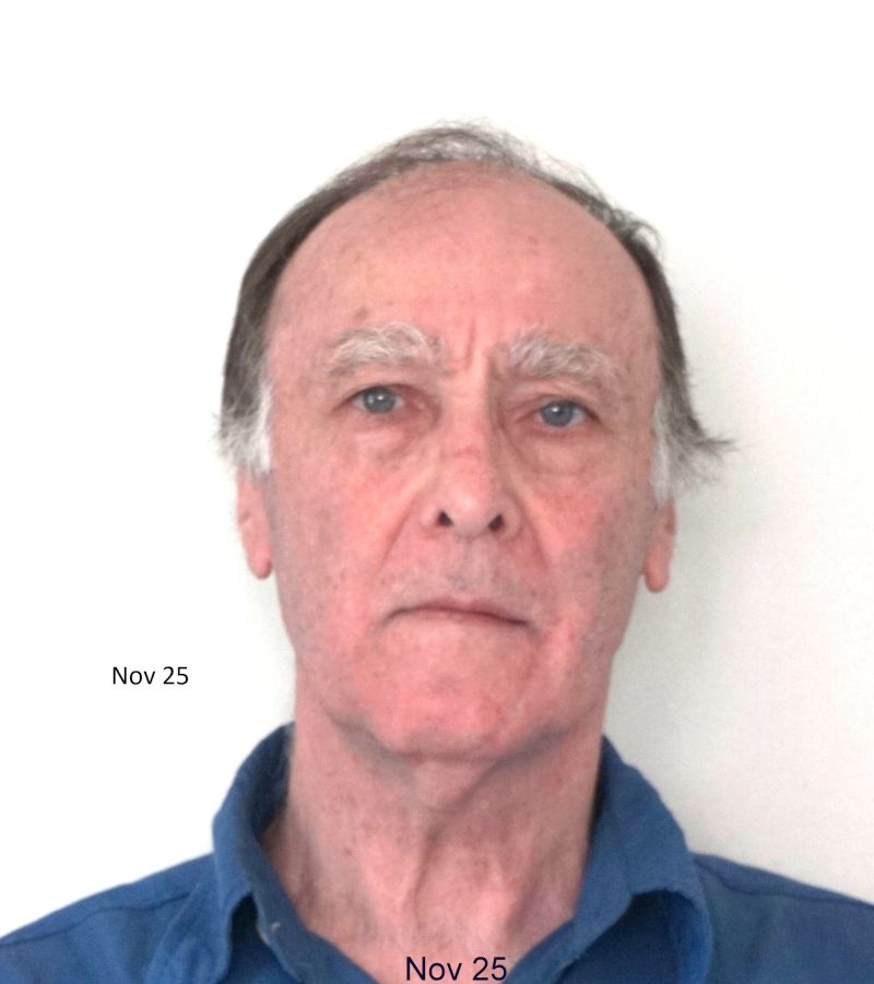 Zestfornature Zestfornature